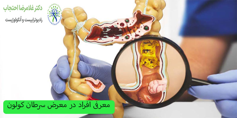 افراد-در-معرض-سرطان-کولون