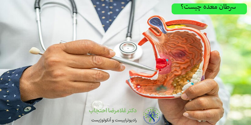 سرطان-معده