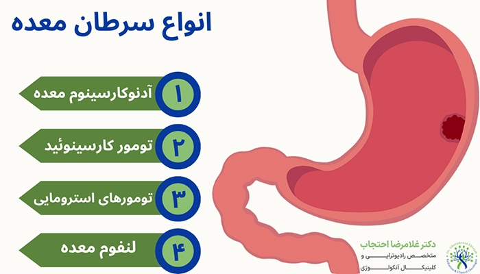 انواع سرطان معده