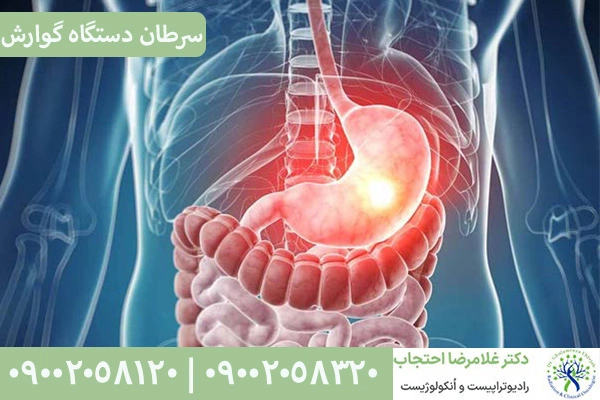علائم سرطان گوارش