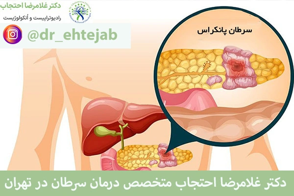 علائم سرطان پانکراس