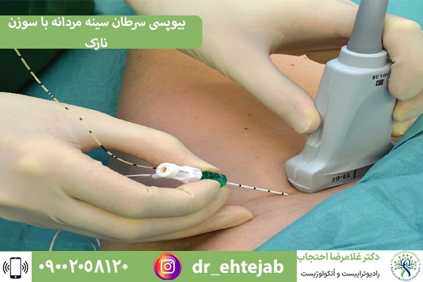 تشخیص سرطان سینه در مردان با بیوپسی