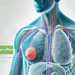 تشخیص سرطان سینه در مردان