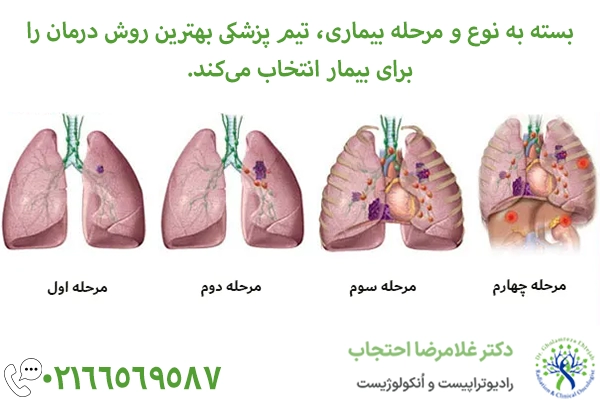 درمان سرطان ریه با توجه به پیشرفت بیماری