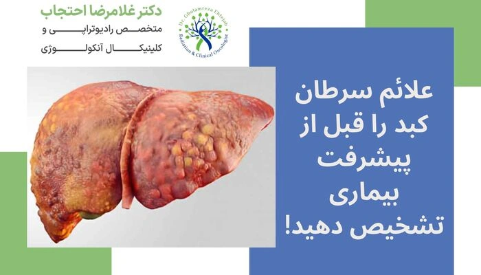 علائم سرطان کبد