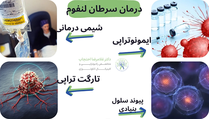 درمان سرطان لنفوم