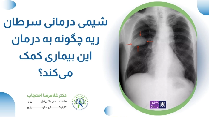 شیمی درمانی سرطان ریه