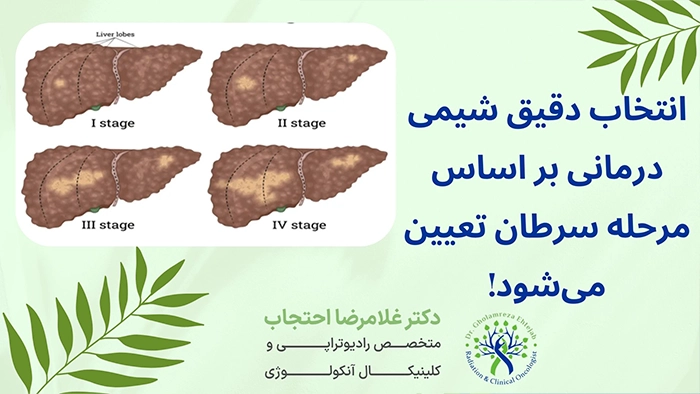 انتخاب درمان شیمی درمانی در سرطان کبد