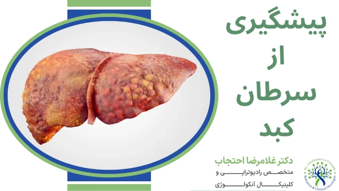 پیشگیری از سرطان کبد