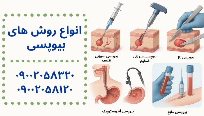انواع روش های بیوپسی