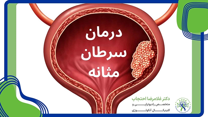 درمان سرطان مثانه