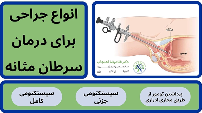 درمان سرطان مثانه با جراحی