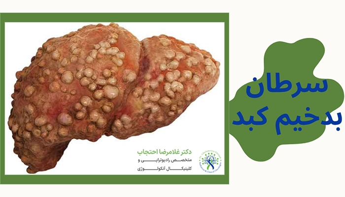 عکس سرطان کبد بدخیم